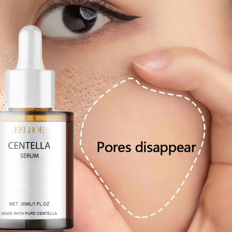 Skincare Oily Skin - Centella Asiatica Face Serum Nourish Dry