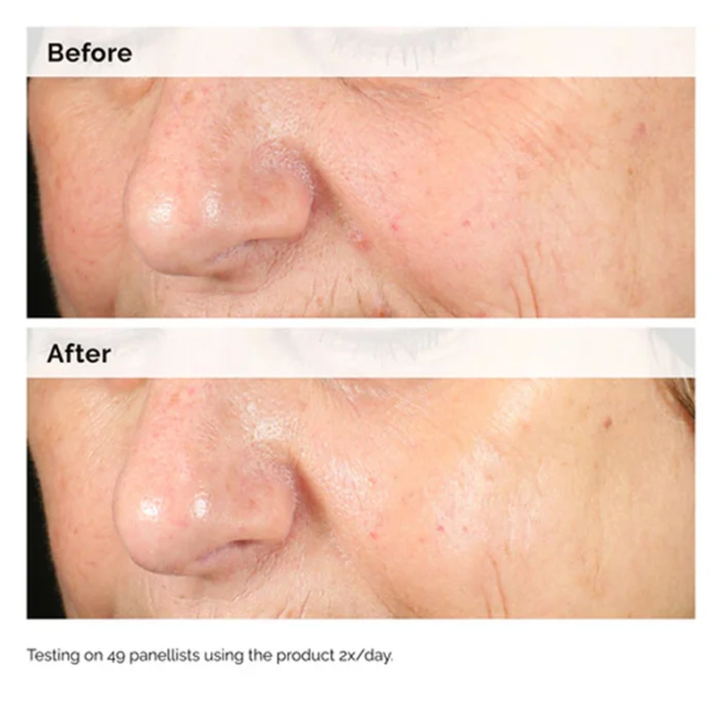 Alpha Arbutin 2% + HA 30ml Ser - đánh giá và giá Skincare Oily Skin