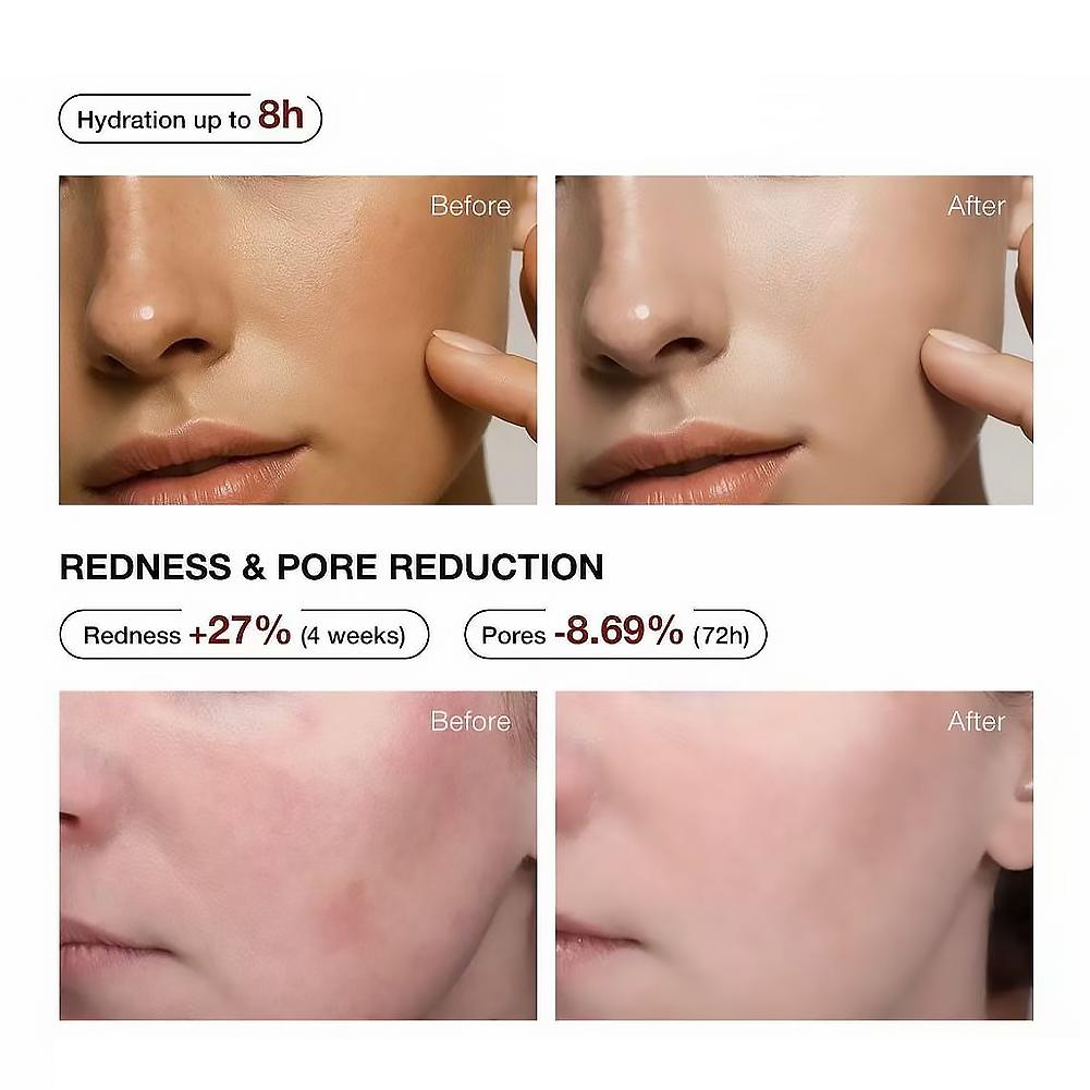 5% Niacinamide & Arbutin Serum - đánh giá và giá Niacinamide Brightening Serum