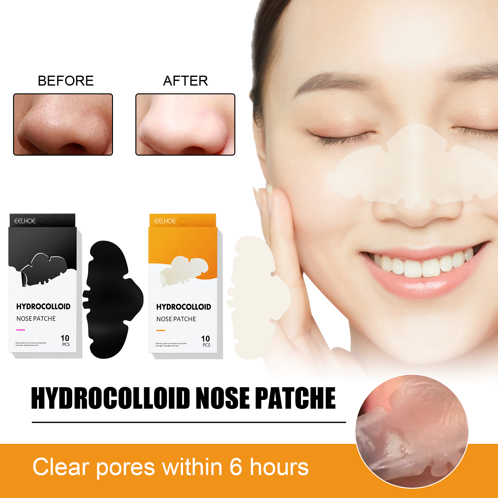 Blackhead Nipper - Hyaluronic  - đánh giá và giá Skincare Oily Skin
