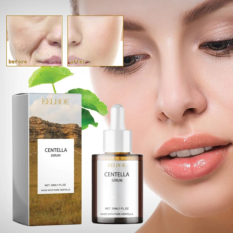 Centella Asiatica Face Serum N - đánh giá và giá Skincare Oily Skin