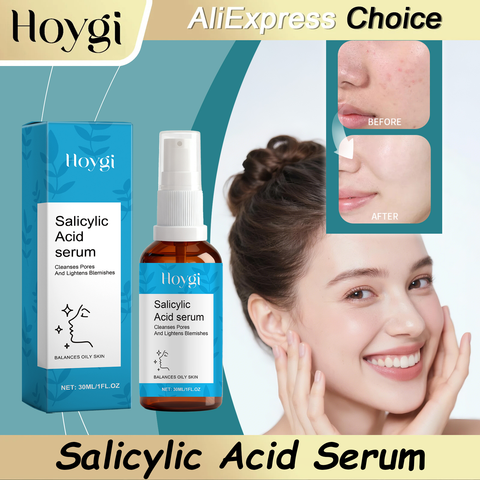 HOYGI Salicylic Acid Anti Acne - đánh giá và giá Skincare Salicylic Acid