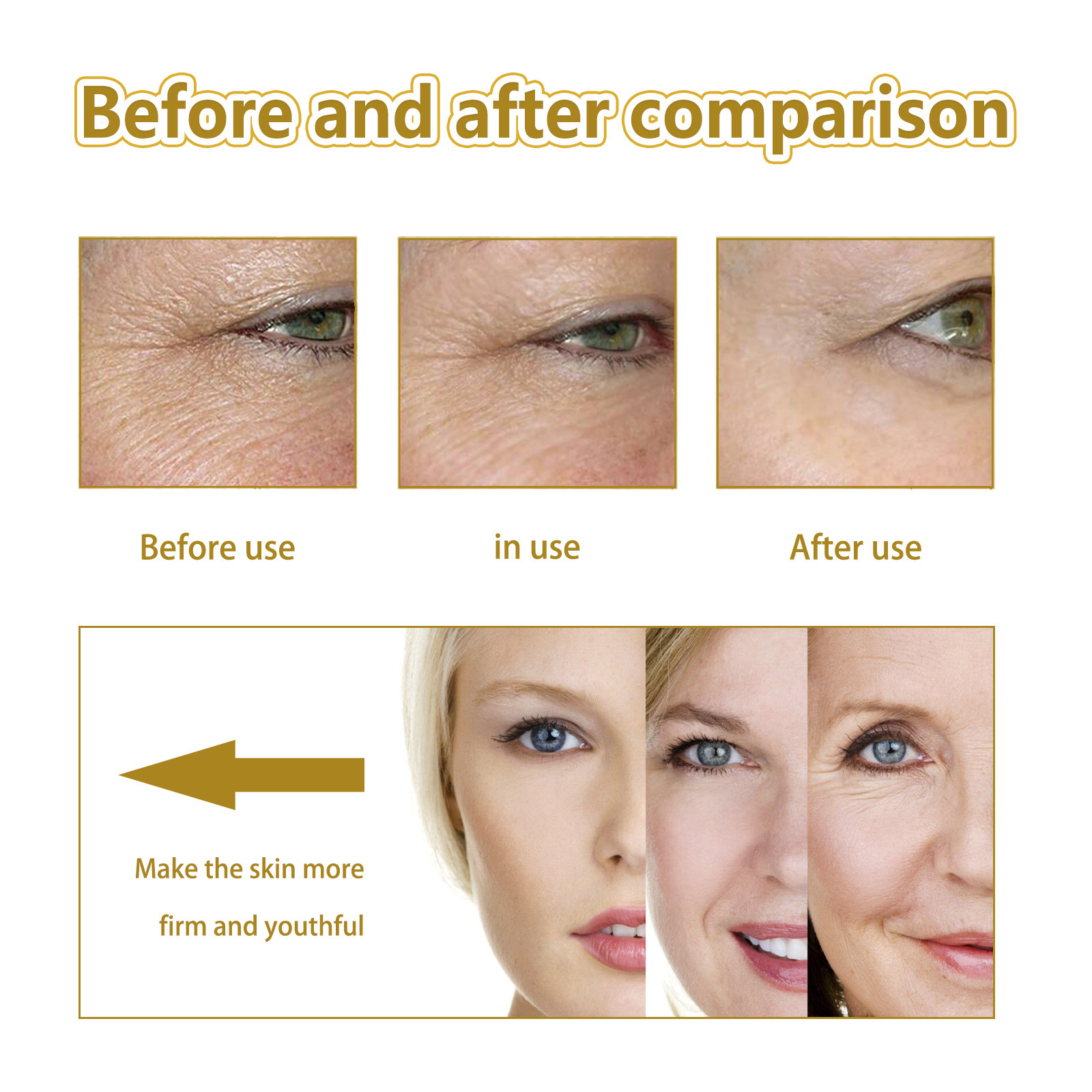 Hoygi Face Essence Fade Fine L - đánh giá và giá Niacinamide Brightening Serum